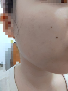 敏感肌連續使用4週就有感！Curél 潤浸保濕超微米精華噴霧，讓妳噴霧不再噴心安