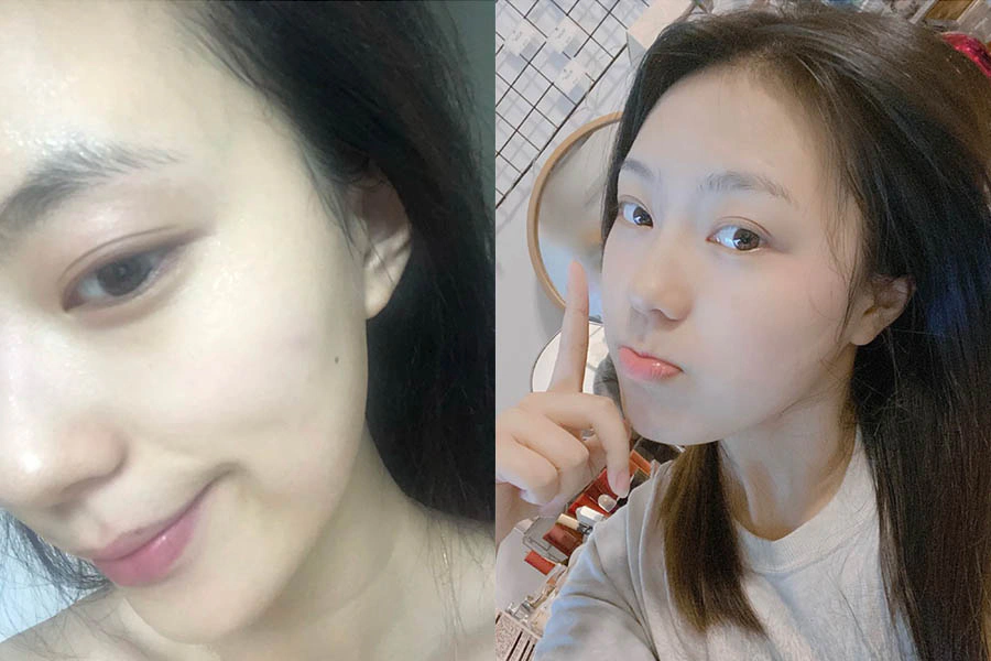 三明治面膜法 優缺點|美周報