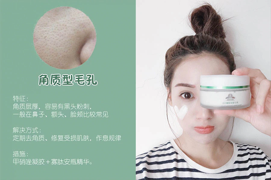 毛孔粗大 改善｜美周報