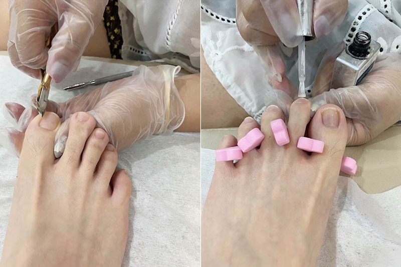 保養 足部 雙腳 涼鞋 腳趾｜美周報