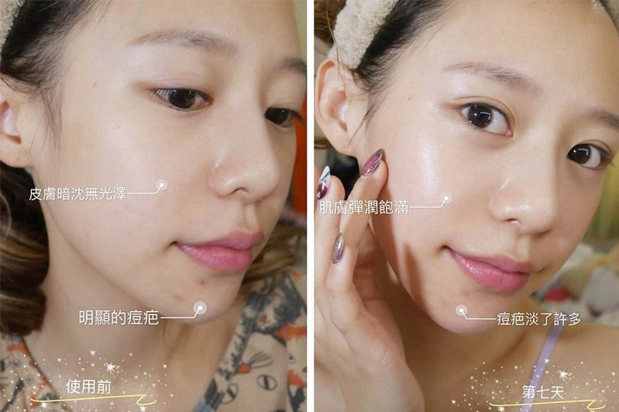 抗老保養 精華液|美周報