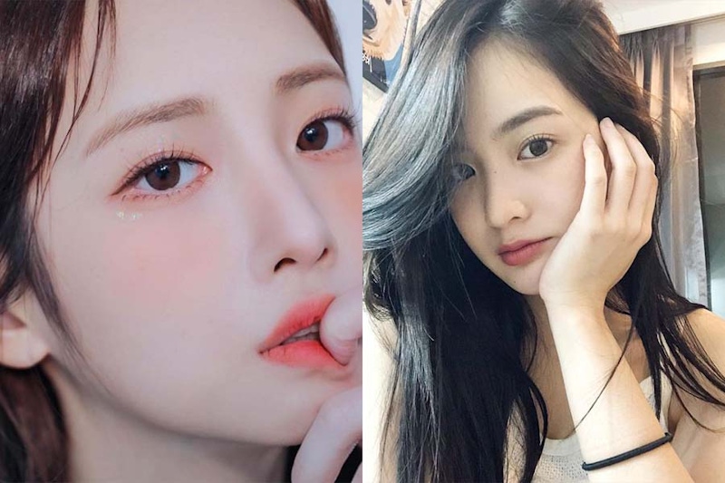 眼周容易出現的問題｜美周報