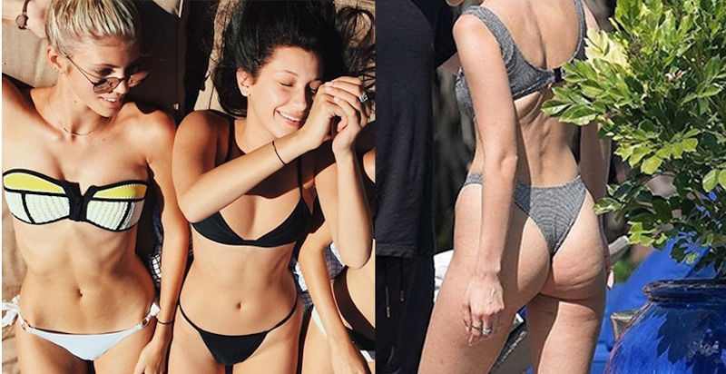 橘皮外露這種糗事，貝拉妹子也中招！4招讓妳和橘皮說再見～