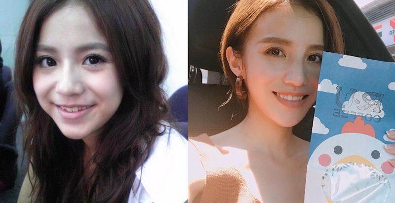 顏值飆升就靠一口整齊漂亮的牙，盤點那些整牙後就像整形的女星～