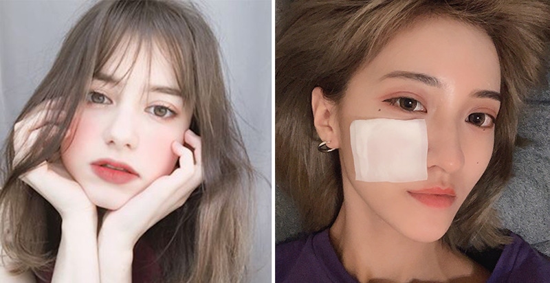 收斂毛孔好重要！擠完粉刺記得濕敷，網友公認最好用的5瓶《收斂化妝水推薦》