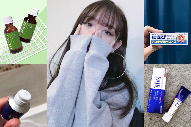 沒臉見人？抗痘心酸血淚史，高CP痘痘藥，消炎抗痘網上認證有效！｜痘痘藥膏推薦