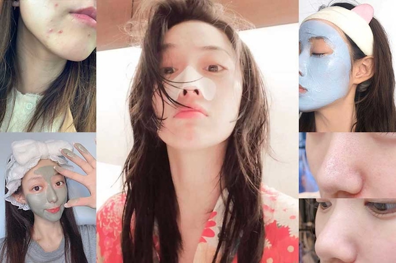 肌膚痘痘、粉刺好惱人！一罐A酸保養品打天下叫作夢，對症下藥才能養出豆腐肌～｜保養知識文